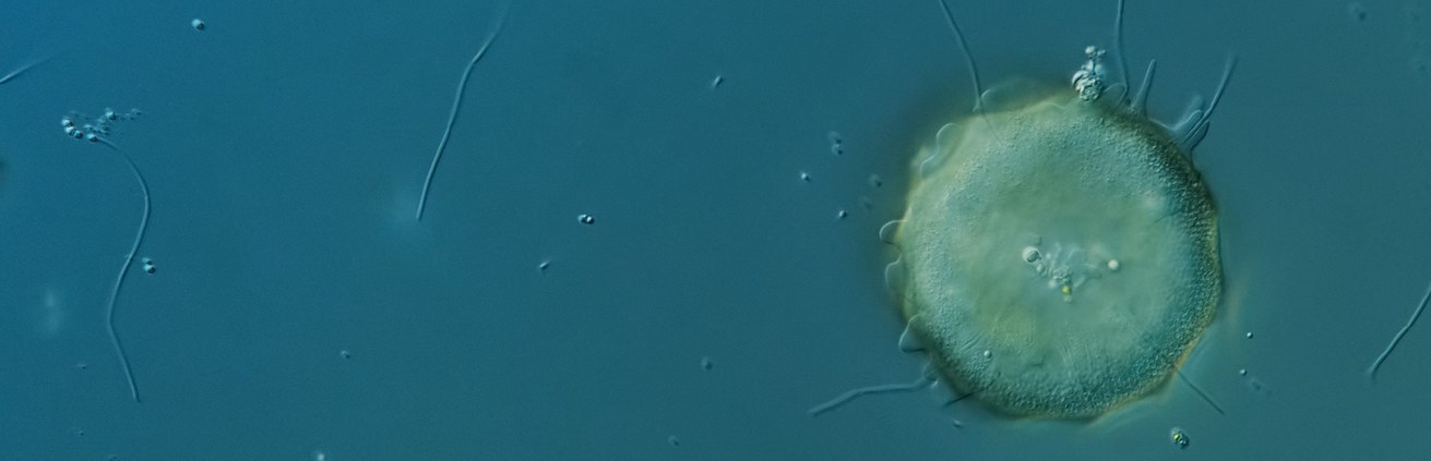 Aquatische Ökosystemanalyse