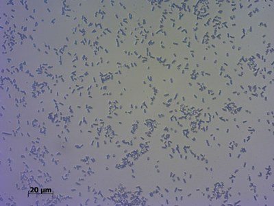 Lukas_Methylenblau.jpg Universität Koblenz