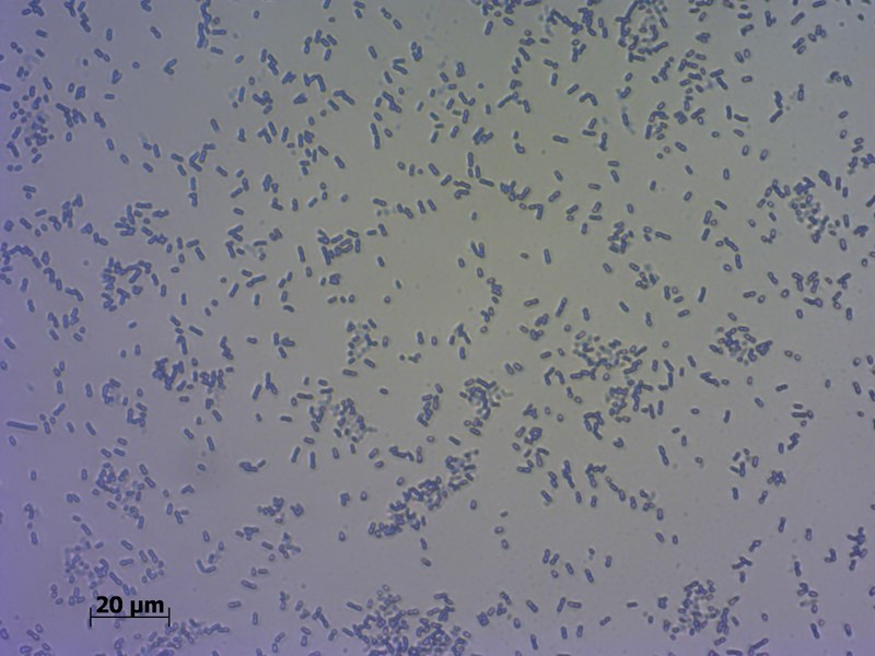 Lukas_Methylenblau.jpg Universität Koblenz