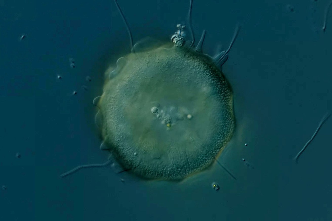 Schalenamöben der Gattung Arcella können problematische fadenförmige Bakterien in Kläranlagen auf natürliche Weise in Schach halten. Bild: James Weiss